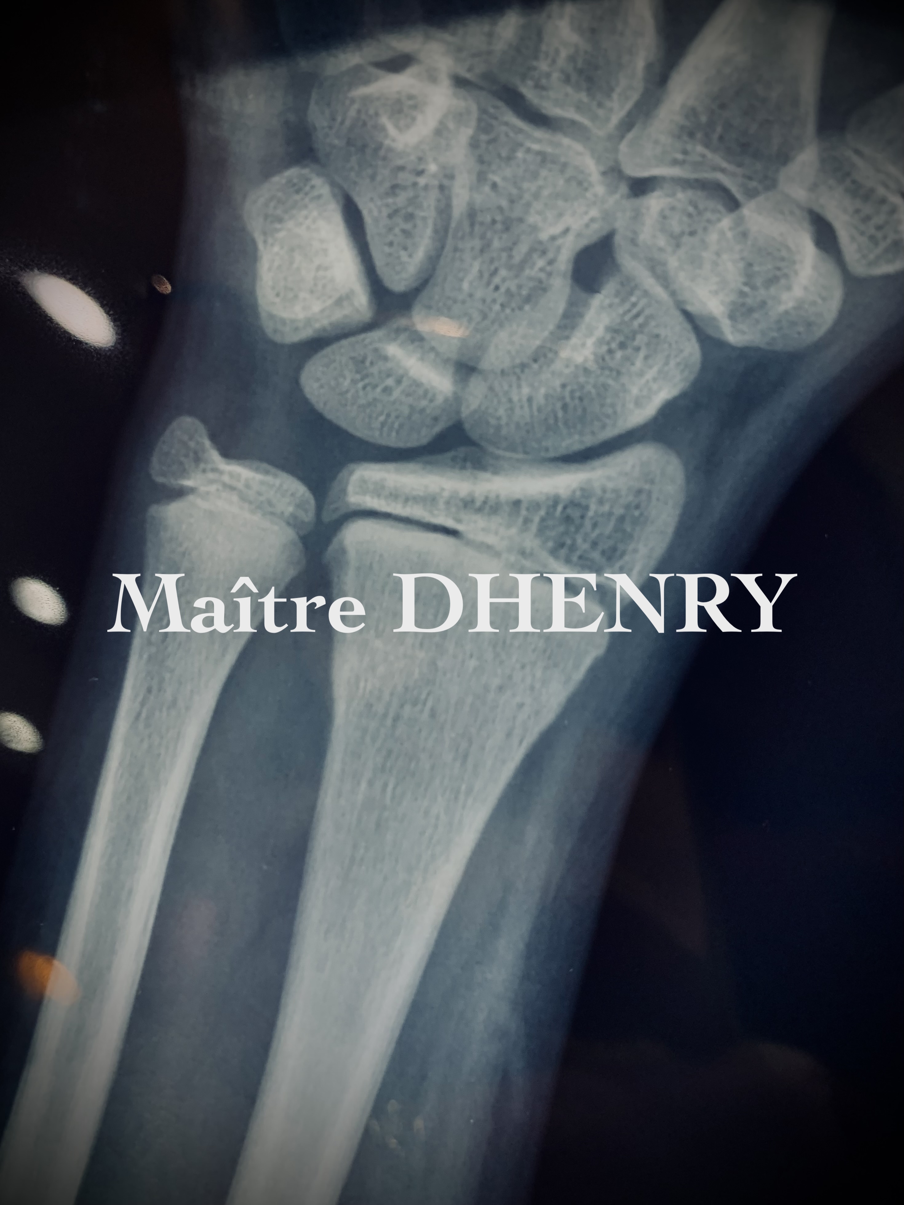 Dommage corporel : qui règle les frais de rééducation et d’ostéopathie ?