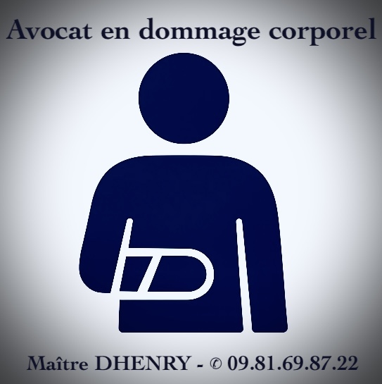 DFP / AIPP : comment peut-il être sous-évalué (et comment contester) ?